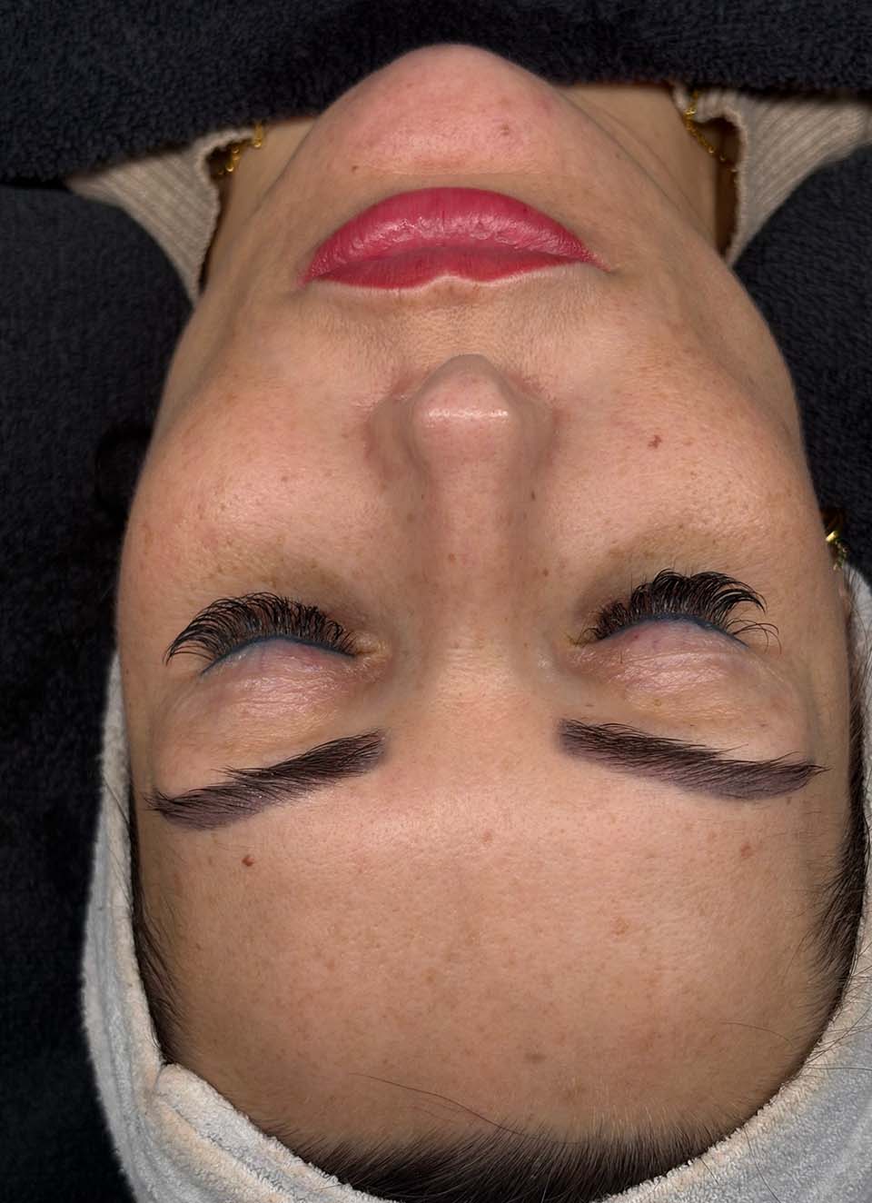 voor-peeling